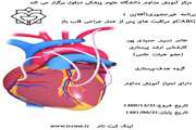 برنامه غیرحضوری(آفلاین)CABG و مراقبت های پس از عمل جراحی قلب باز